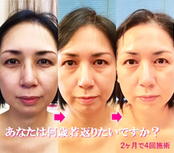 まちくら5月号掲載 キレイ お顔も 頭皮も 時間を巻き戻す 若返り施術 再生美容サポートエステ One S Own 岡山の街の元気をお手伝いする生活情報誌 このまちでくらす 株式会社ウェルスマイル